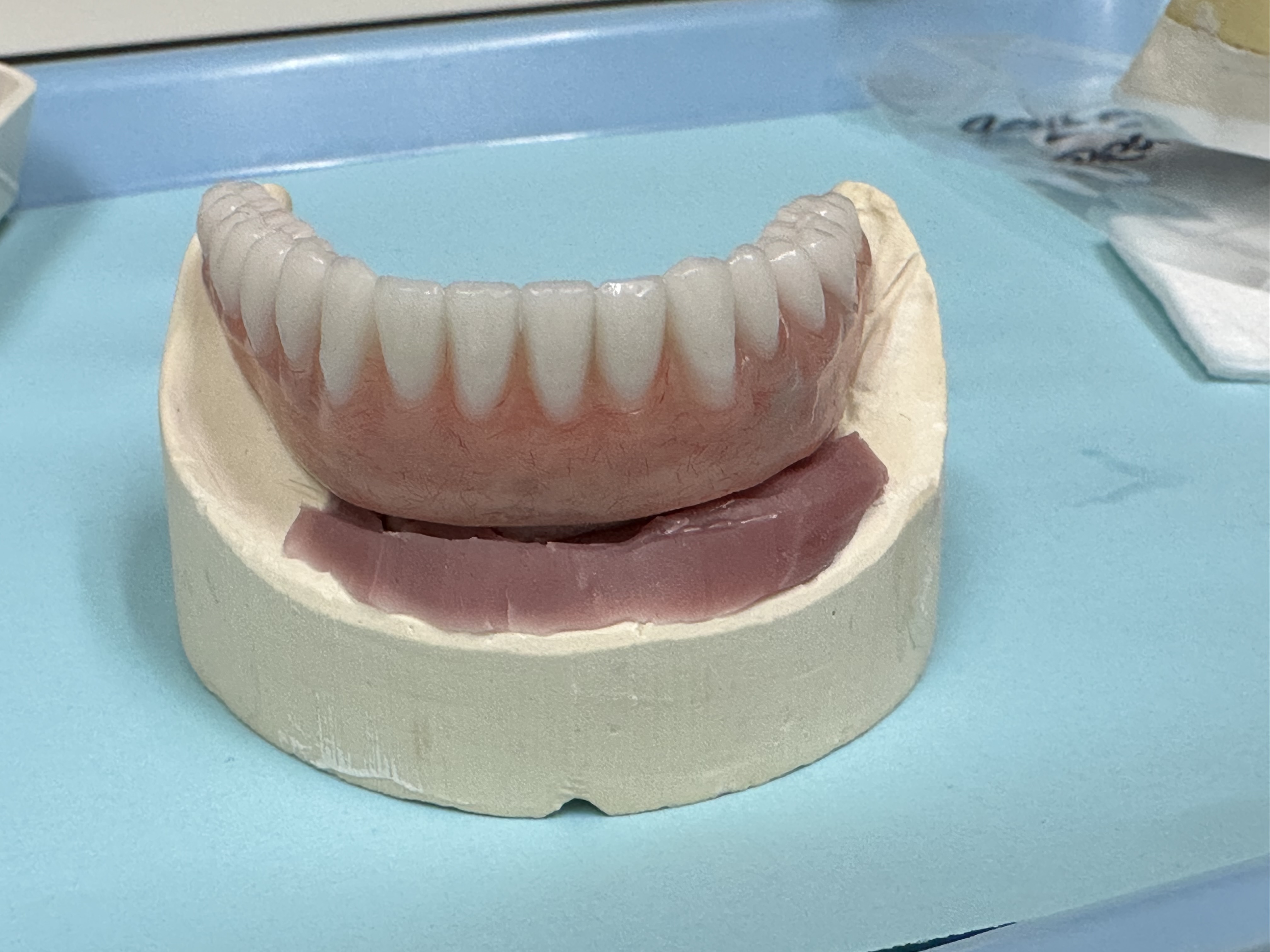 Finished denture prosthetic